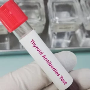 Anti – Thyroid Antibody..1