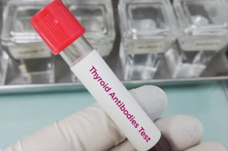 Anti – Thyroid Antibody..1