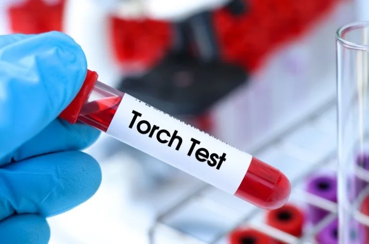 Torch Profile---1