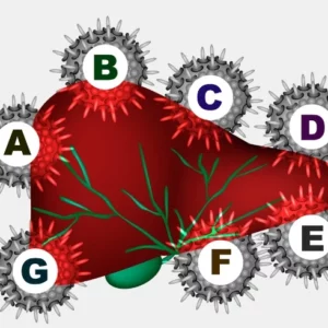 Viral Hepatitis Markers--1