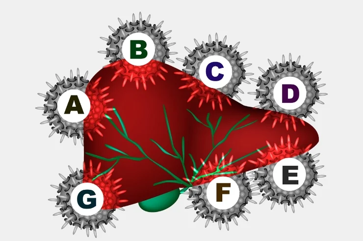 Viral Hepatitis Markers--1